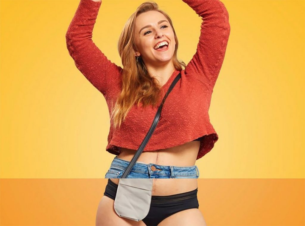 Hannah Witton (Youtube Star) Wiki, Age, Biography, Boyfriend, Family and More Photo